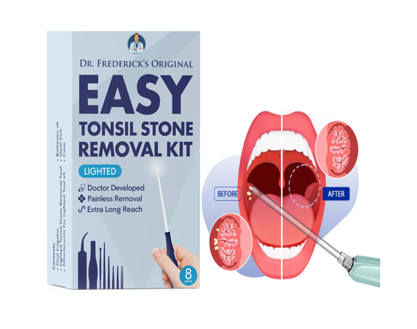 Best Tonsil Stone Removers