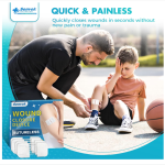 Best Wound Closure Strips