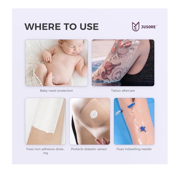 Best Transparent Film Wound Dressing