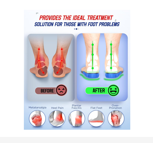 7 Best Insoles For Plantar Fasciitis Relief
