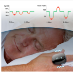 Best O2ring Pulse Oximeters