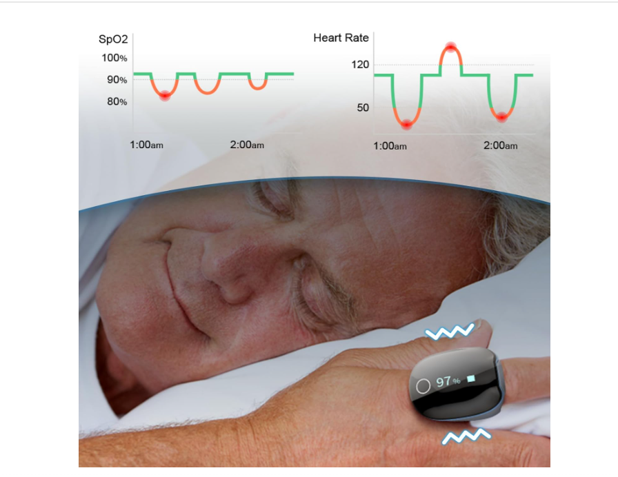 Best O2ring Pulse Oximeters